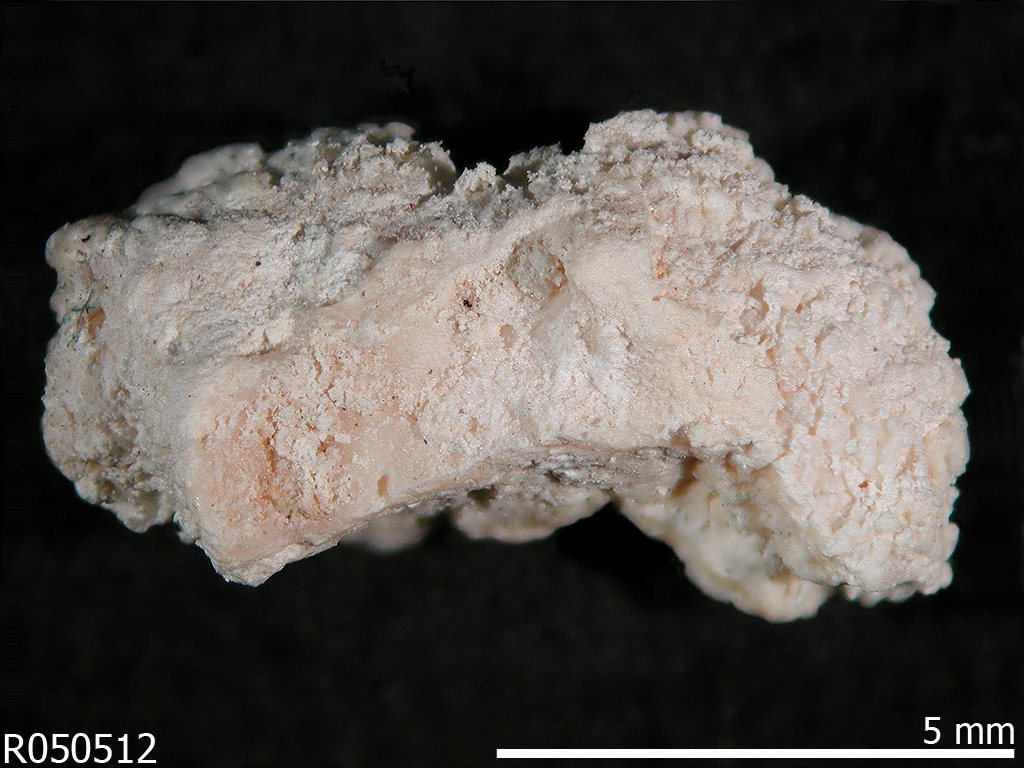 Hydroxylapatite Alchetron, The Free Social Encyclopedia